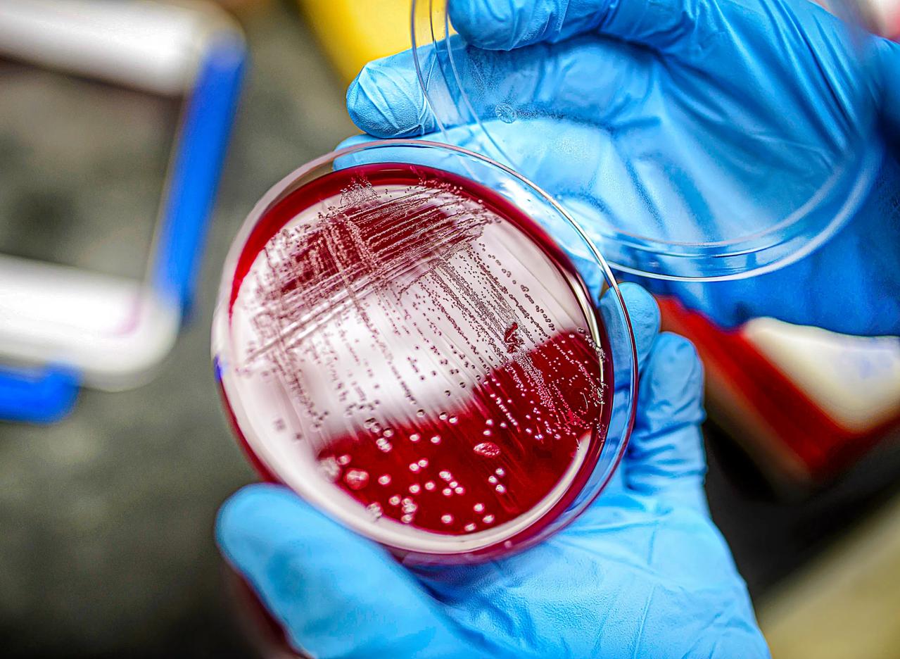 Two gloved hands hold a petri dish in a lab.
