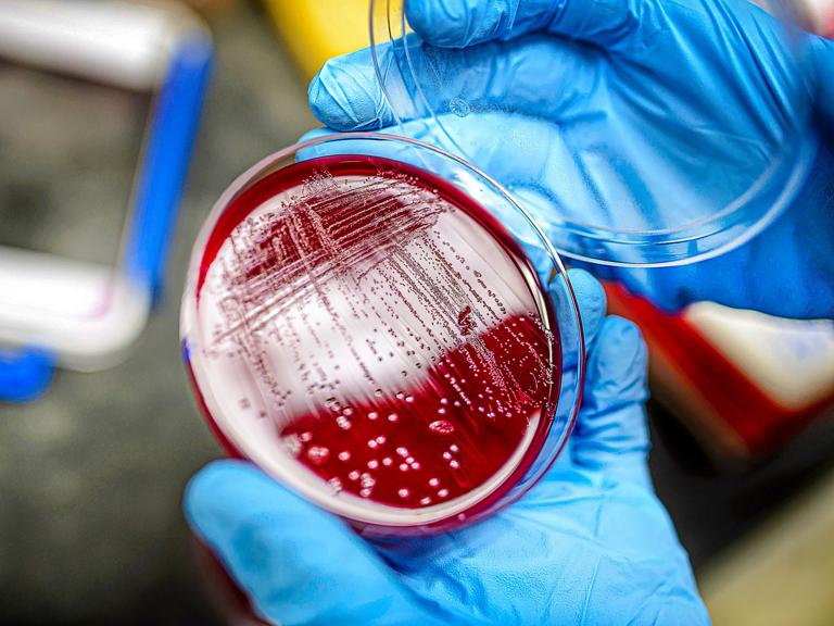 Two gloved hands hold a petri dish in a lab.