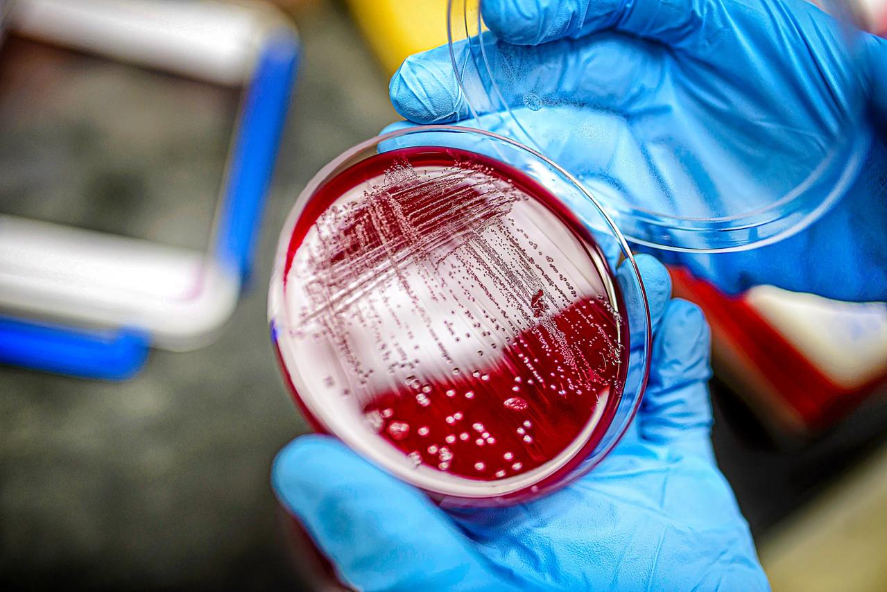Two gloved hands hold a petri dish in a lab.