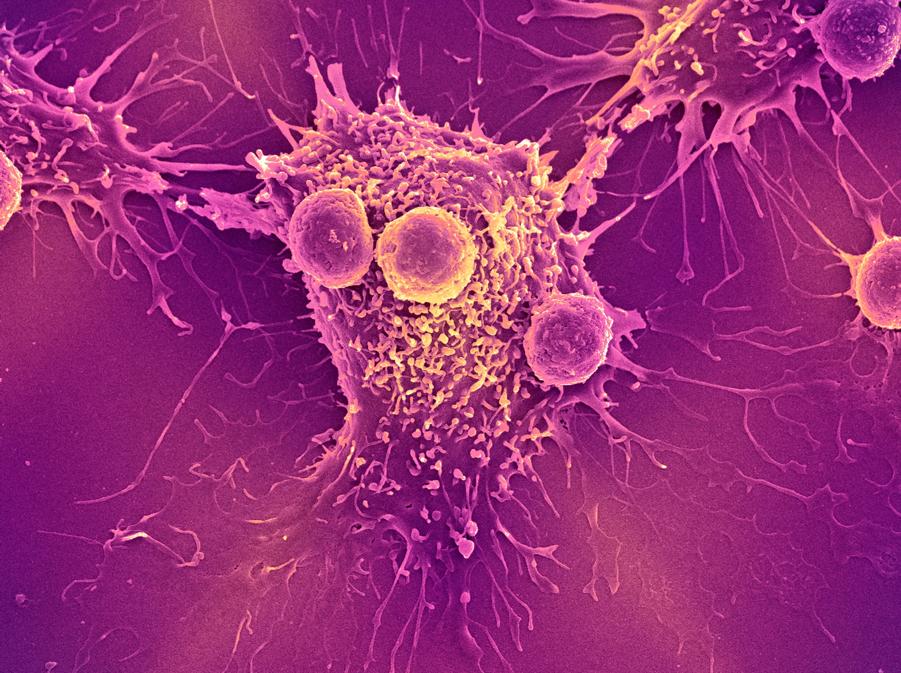 microscopic image of a large, irregular cell with branching extensions, surrounded by several round cells on a vivid purple and pink background.