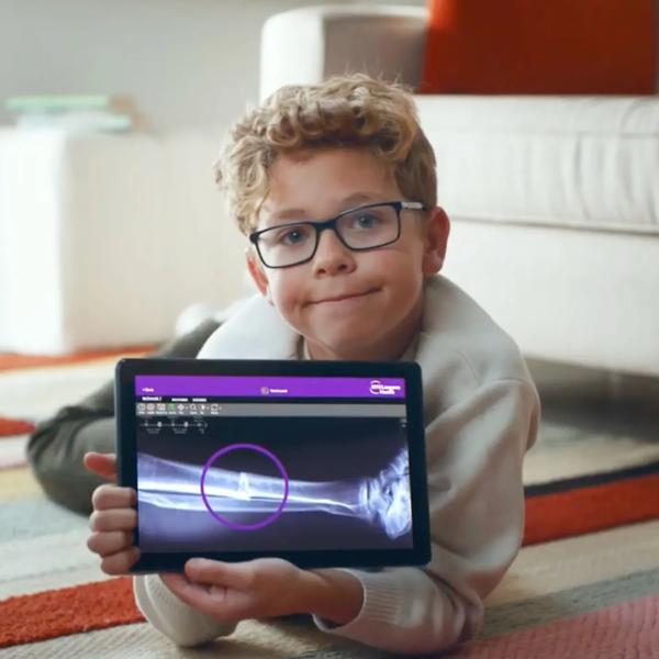 A male pediatric patient lies on the floor while holding a tablet, which displays an X-ray image of his leg.
