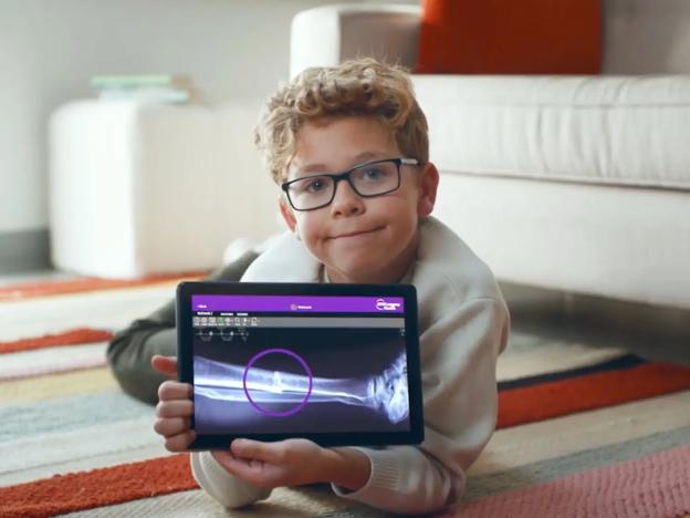 A male pediatric patient lies on the floor while holding a tablet, which displays an X-ray image of his leg.