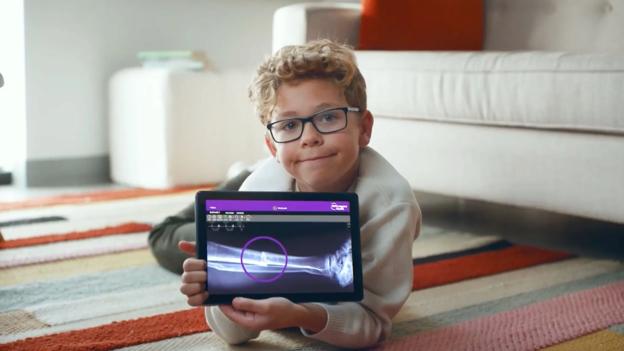 A male pediatric patient lies on the floor while holding a tablet, which displays an X-ray image of his leg.